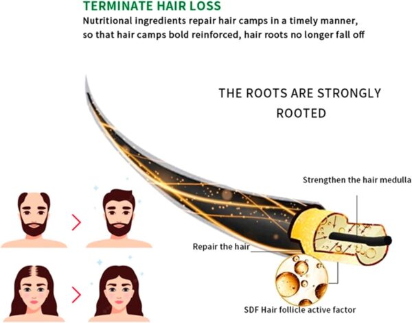 Anti-Hair Loss Spray Tonic Deep Moisturize Nourish Repair Strengthen Hair Root Anti-Frizz Care 30ml - Image 8