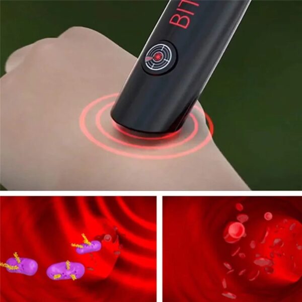 Mosquito Bite Helper – Insect Bite Relief, Useful For Summer, Helps Children, Insect Bites, Adults, Irritation, Itching, Neutralizer, Relieve Stings (Cell operated ) - Image 4